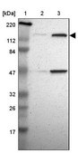 Anti-TTF2 antibody produced in rabbit Prestige Antibodies&#174; Powered by Atlas Antibodies, affinity isolated antibody, buffered aqueous glycerol solution