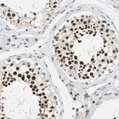 Anti-XRCC4 antibody produced in rabbit Prestige Antibodies&#174; Powered by Atlas Antibodies, affinity isolated antibody, buffered aqueous glycerol solution