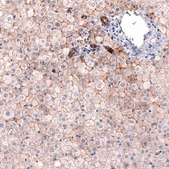 Monoclonal Anti-CLDN1 antibody produced in mouse Prestige Antibodies&#174; Powered by Atlas Antibodies, clone CL3698, purified immunoglobulin, buffered aqueous glycerol solution