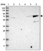 Anti-KLHL26 antibody produced in rabbit Prestige Antibodies&#174; Powered by Atlas Antibodies, affinity isolated antibody, buffered aqueous glycerol solution