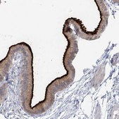 Anti-SLC9A3 antibody produced in rabbit Prestige Antibodies&#174; Powered by Atlas Antibodies, affinity isolated antibody, buffered aqueous glycerol solution