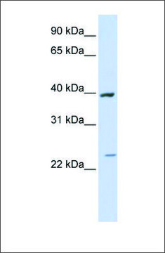 Anti-ACADL antibody produced in rabbit affinity isolated antibody