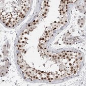 Anti-POLD2 antibody produced in rabbit Prestige Antibodies&#174; Powered by Atlas Antibodies, affinity isolated antibody, buffered aqueous glycerol solution