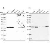 Anti-ANXA2 Prestige Antibodies&#174; Powered by Atlas Antibodies, affinity isolated antibody