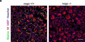 Monoclonal Anti-Neurofilament 200 (Phos. and Non-Phos.) antibody produced in mouse clone N52, ascites fluid