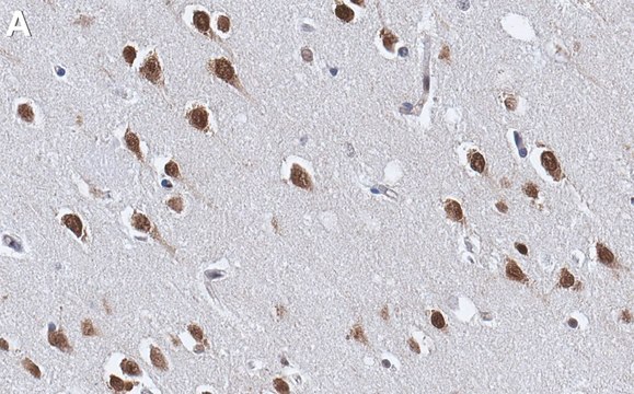 Anti-NOVA2 Antibody, clone 2J16 ZooMAb&#174; Rabbit Monoclonal recombinant, expressed in HEK 293 cells