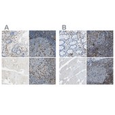 Anti-ITGB2 antibody produced in rabbit Prestige Antibodies&#174; Powered by Atlas Antibodies, affinity isolated antibody, buffered aqueous glycerol solution
