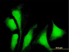Anti-G3BP1 antibody produced in mouse purified immunoglobulin, buffered aqueous solution