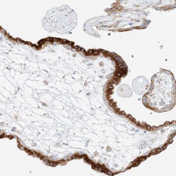 Anti-STK11IP antibody produced in rabbit Prestige Antibodies&#174; Powered by Atlas Antibodies, affinity isolated antibody, buffered aqueous glycerol solution
