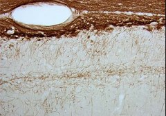 Anti-Myelin Associated Glycoprotein Antibody, clone 513 clone 513, Chemicon&#174;, from mouse