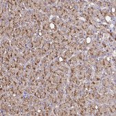 Anti-CAT antibody produced in rabbit Prestige Antibodies&#174; Powered by Atlas Antibodies, affinity isolated antibody, buffered aqueous glycerol solution