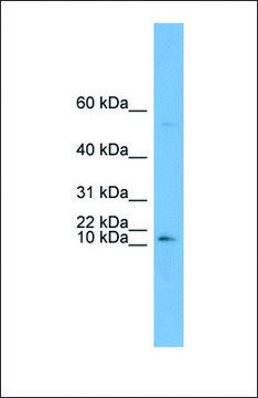 Anti-ATP6V0C antibody produced in rabbit affinity isolated antibody