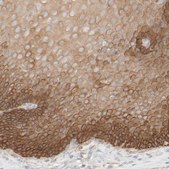 Anti-KRT15 antibody produced in rabbit Prestige Antibodies&#174; Powered by Atlas Antibodies, affinity isolated antibody, buffered aqueous glycerol solution