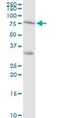 Anti-PRKCH antibody produced in rabbit purified immunoglobulin, buffered aqueous solution