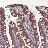 Anti-CHST5 antibody produced in rabbit Prestige Antibodies&#174; Powered by Atlas Antibodies, affinity isolated antibody, buffered aqueous glycerol solution
