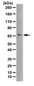 Anti-GLUT9 Antibody from rabbit, purified by affinity chromatography