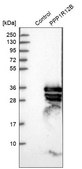 Anti-PPP1R12B antibody produced in rabbit Prestige Antibodies&#174; Powered by Atlas Antibodies, affinity isolated antibody, buffered aqueous glycerol solution, Ab1