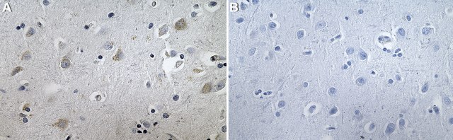 Anti-LNPEP/IRAP Antibody, clone 1G23 ZooMAb&#174; Rabbit Monoclonal recombinant, expressed in HEK 293 cells