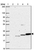 Anti-HAGH antibody produced in rabbit Prestige Antibodies&#174; Powered by Atlas Antibodies, affinity isolated antibody, buffered aqueous glycerol solution