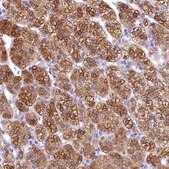 Anti-TIMM22 antibody produced in rabbit Prestige Antibodies&#174; Powered by Atlas Antibodies, affinity isolated antibody, buffered aqueous glycerol solution