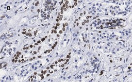 Anti-Lamin B1 Antibody, clone 6K22, ZooMAb&#174; Rabbit Monoclonal recombinant, expressed in HEK 293 cells