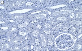 Anti-Mucin-14/EMCN Antibody, clone 1E8 ZooMAb&#174; Rabbit Monoclonal recombinant, expressed in HEK 293 cells
