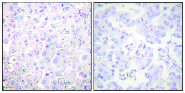 Anti-Cadherin-pan antibody produced in rabbit affinity isolated antibody