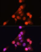 Anti- CDKN2A/p16INK4a antibody produced in rabbit