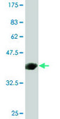 Monoclonal Anti-C4B antibody produced in mouse clone 1F2, purified immunoglobulin, buffered aqueous solution