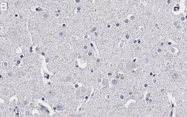 Anti-NSE/Enolase-2 Antibody, clone 2J18-H1 ZooMAb&#174; Rabbit Monoclonal recombinant, expressed in HEK 293 cells