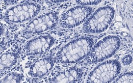 Anti-Mn-SOD Antibody, clone 1C14 ZooMAb&#174; Rabbit Monoclonal recombinant, expressed in HEK 293 cells