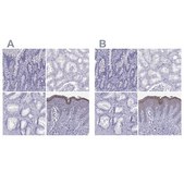 Anti-LOR Prestige Antibodies&#174; Powered by Atlas Antibodies, affinity isolated antibody
