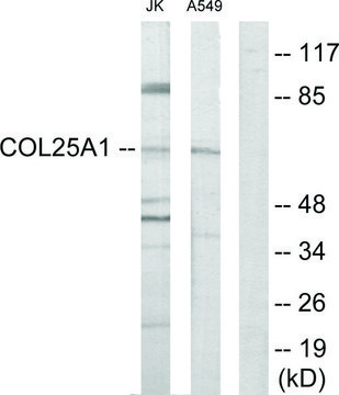 Anti-Collagen XXV &#945;1 antibody produced in rabbit affinity isolated antibody