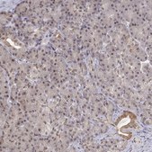 Anti-BRCA1 Prestige Antibodies&#174; Powered by Atlas Antibodies, affinity isolated antibody