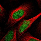 Anti-POLR2A antibody produced in rabbit Prestige Antibodies&#174; Powered by Atlas Antibodies, affinity isolated antibody, buffered aqueous glycerol solution