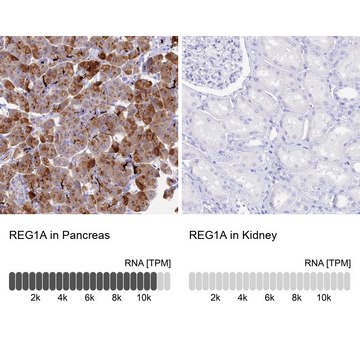 Anti-REG1A antibody produced in rabbit Prestige Antibodies&#174; Powered by Atlas Antibodies, affinity isolated antibody, buffered aqueous glycerol solution