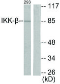 Anti-IKK-&#946; antibody produced in rabbit affinity isolated antibody