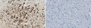 Anti-Opioid Receptor &#956; Antibody, clone 1E5 ZooMAb&#174; Rabbit Monoclonal recombinant, expressed in HEK 293 cells