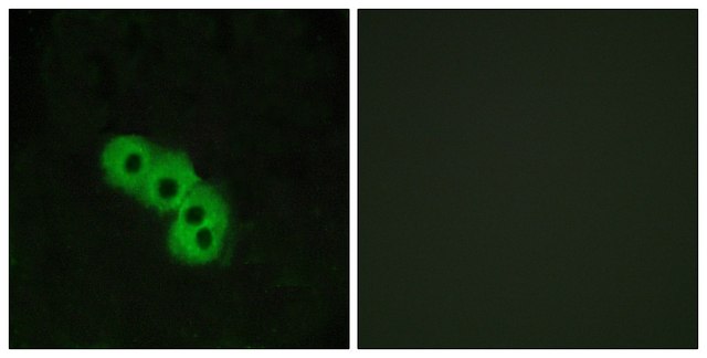 Anti-GPR109 antibody produced in rabbit affinity isolated antibody