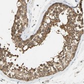 Anti-PRMT5 antibody produced in rabbit Prestige Antibodies&#174; Powered by Atlas Antibodies, affinity isolated antibody, buffered aqueous glycerol solution
