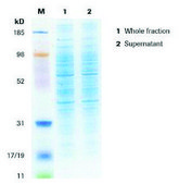 cOmplete&#8482; Lysis-M storage temp.:room temp