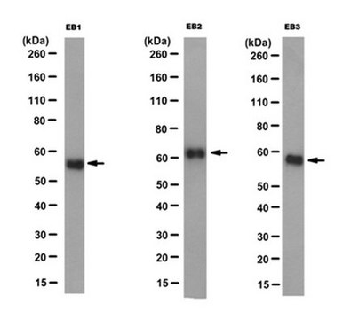 Anti-EB1, EB2 and EB3 Antibody, clone KT65 clone KT65, from rat