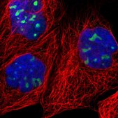 Anti-RRP1 antibody produced in rabbit Prestige Antibodies&#174; Powered by Atlas Antibodies, affinity isolated antibody, buffered aqueous glycerol solution, Ab1