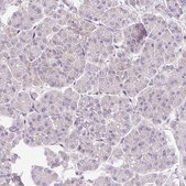 Anti-IMMT antibody produced in rabbit Prestige Antibodies&#174; Powered by Atlas Antibodies, affinity isolated antibody, buffered aqueous glycerol solution