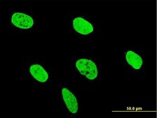 ANTI-RUNX2 antibody produced in mouse clone 3F5, purified immunoglobulin, buffered aqueous solution