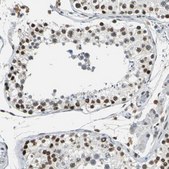 Anti-GATAD2A antibody produced in rabbit Prestige Antibodies&#174; Powered by Atlas Antibodies, affinity isolated antibody, buffered aqueous glycerol solution