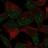 Anti-ZNF677 antibody produced in rabbit Prestige Antibodies&#174; Powered by Atlas Antibodies, affinity isolated antibody, buffered aqueous glycerol solution, Ab1