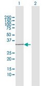 Anti-POMC antibody produced in rabbit purified immunoglobulin, buffered aqueous solution