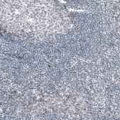 Monoclonal Anti--G6PC antibody produced in mouse Prestige Antibodies&#174; Powered by Atlas Antibodies, clone CL5817, purified immunoglobulin, buffered aqueous glycerol solution