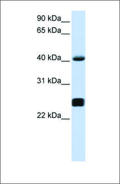 Anti-SERPINA3 antibody produced in rabbit affinity isolated antibody